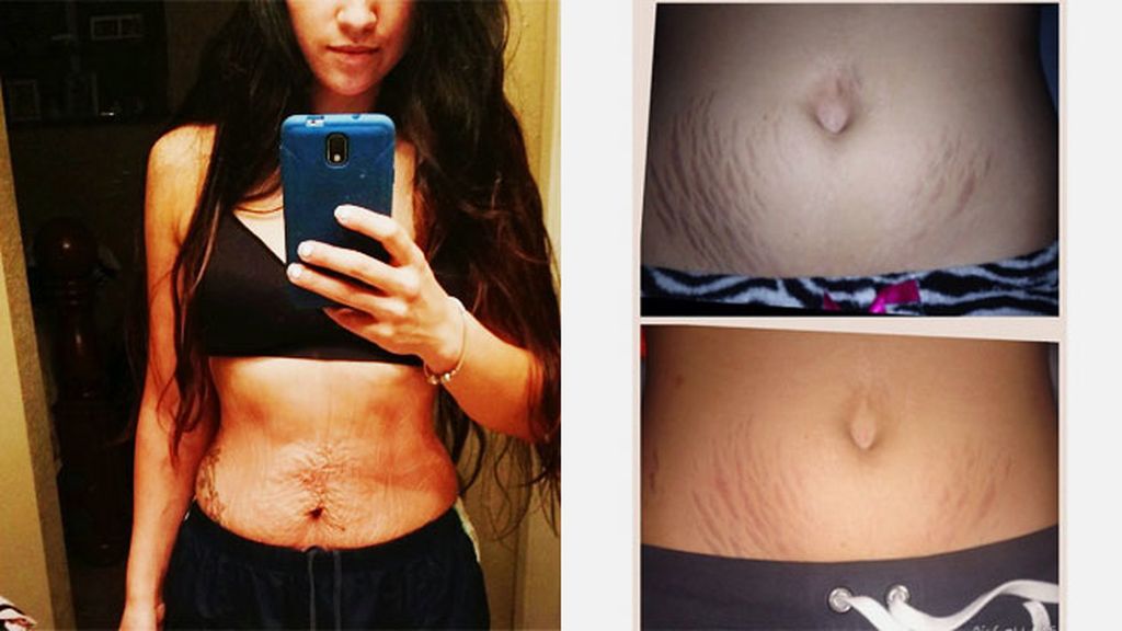 Sin complejos tras el emabrazo