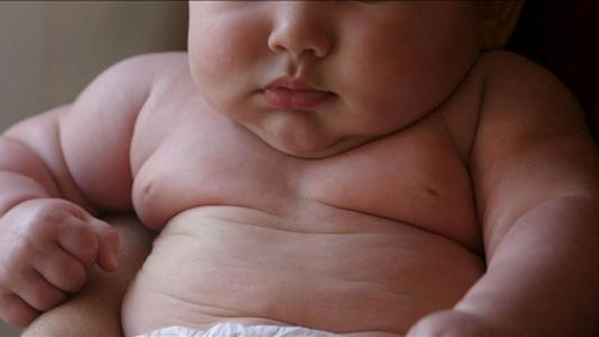 Un bebé con problemas de obesidad. EFE/Archivo