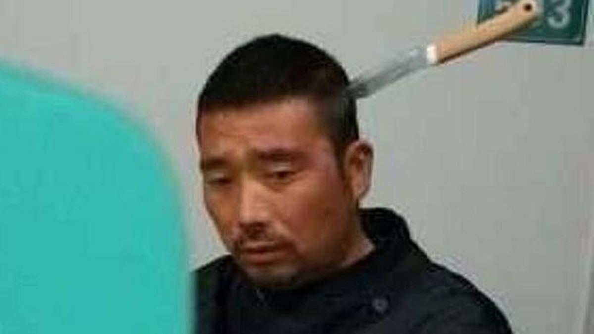 Un hombre con un cuchillo clavado en la cabeza espera en el hospital