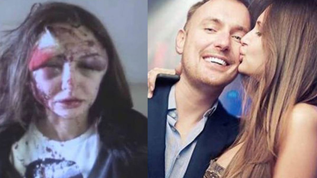 En busca y captura tras desfigurar el rostro a su novia, la modelo Alexandra Sereda