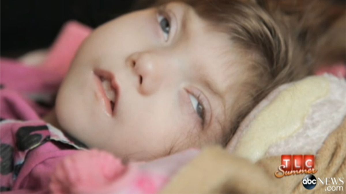 La extraña enfermedad de una niña de 8 años podría ser la llave de la inmortalidad biológica