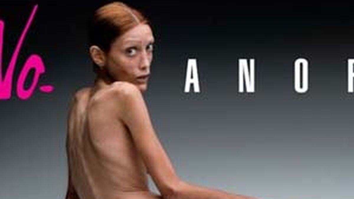 Isabelle Caro en la campaña contra la anorexia.
