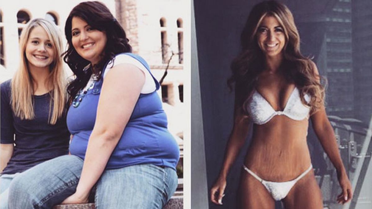 Una mujer con obesidad mórdida pierde la mitad de su peso y gana un concurso de bikinis