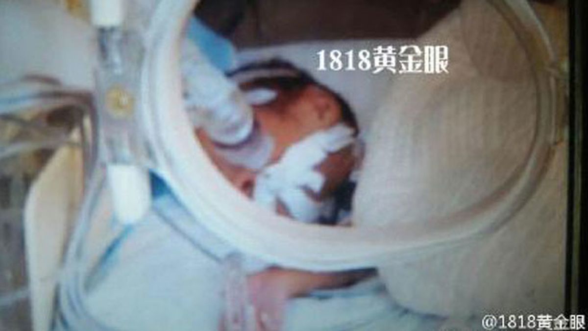 Un recién nacido es declarado muerto y momentos antes de ser incinerado comienza a llorar