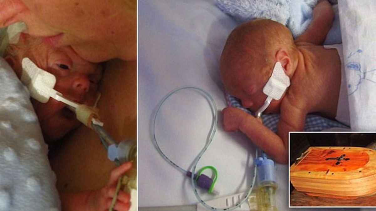 Muere un bebé después de que una enfermera le retirara un ventilador sin permiso