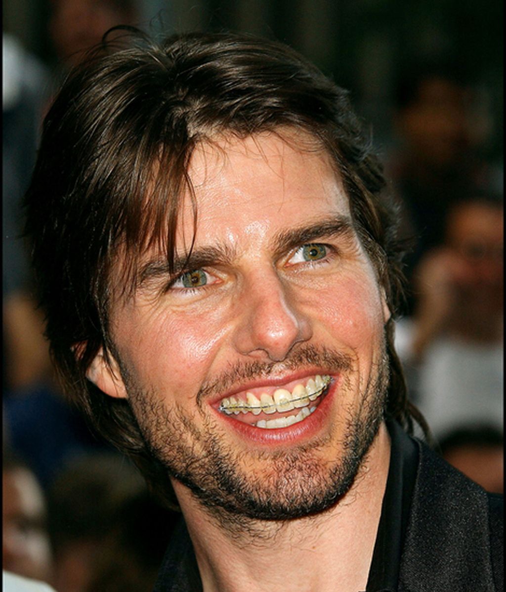 Tom Cruise, mostrando sin pudor su corrector de dientes