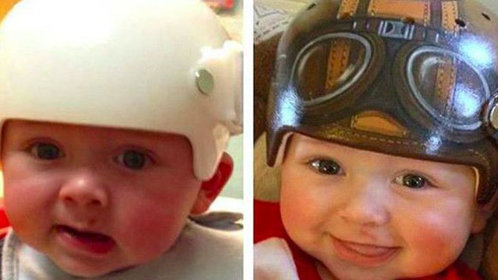 Los cascos médicos más divertidos