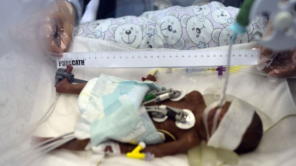 Un bebé de 0,75 kilogramos nace prematuramente en China