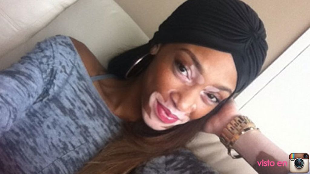 En entrevistas ha confesado que tuvo que luchar con los insultos como cebra o vaca