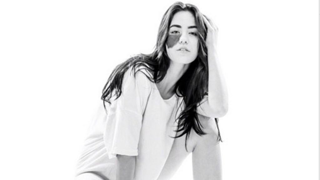 Nació con un lunar en su cara que la hace especial