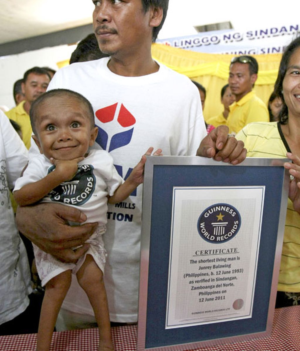 El hombre más pequeño del mundo