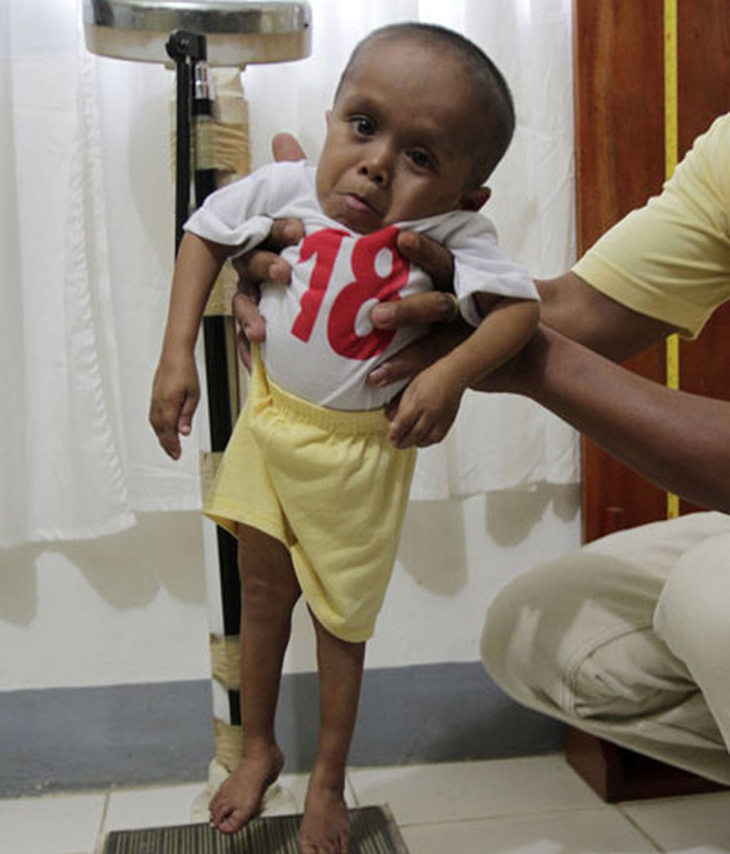 El hombre más pequeño del mundo