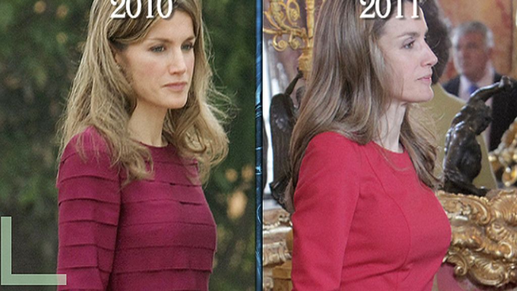 Las fotos del antes y el después de las operaciones estéticas de Letizia Ortiz