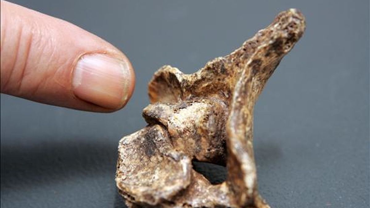 El paleopatólogo riojano Julio Martínez Flórez, señala con el dedo el primer hallazgo de una vértebra perteneciente a un hombre del Neolítico que sufrió un cáncer óseo dentro de la médula espinal, dado que, según sus datos, no hay constancia de este tipo de tumor en este periodo histórico. EFE