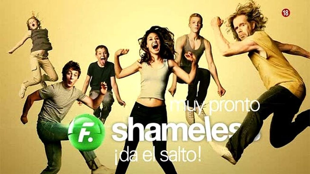 Shameless
