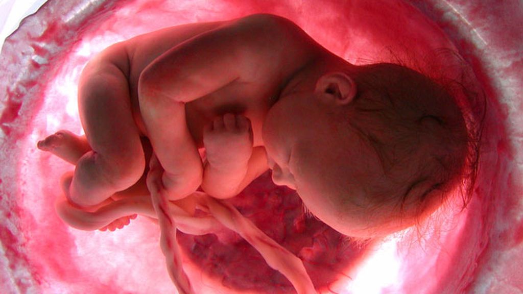 Fotos De Fetos De 5 Meses