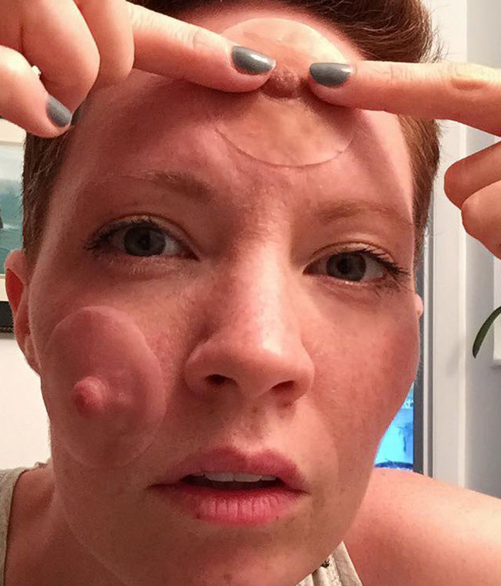 Cómo esta modelo superó el cáncer de mama usando el humor