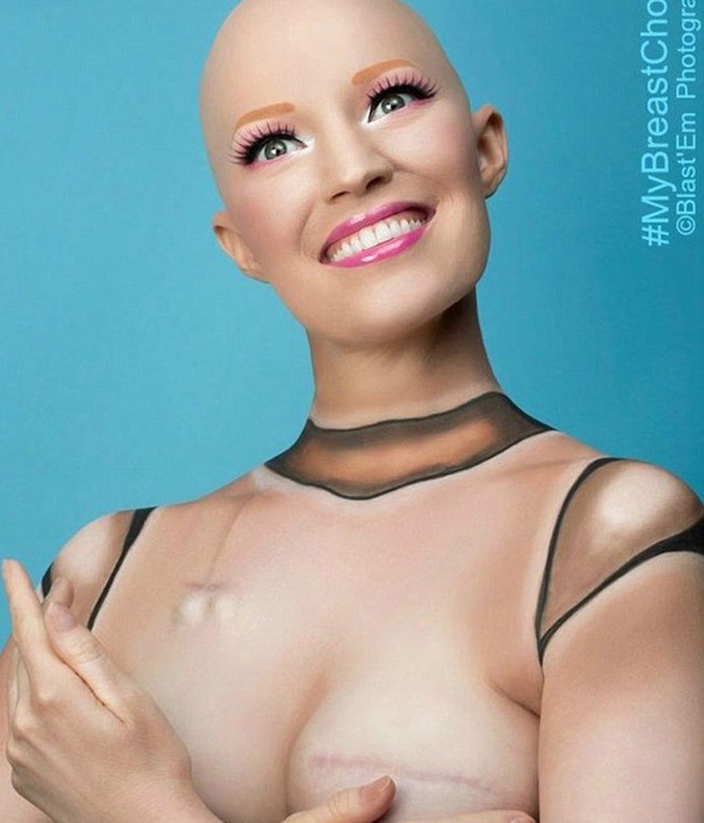 Cómo esta modelo superó el cáncer de mama usando el humor