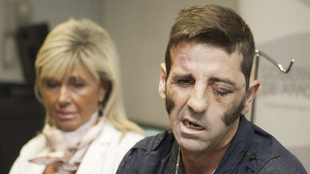 El torero Juan José Padilla sale del hospital