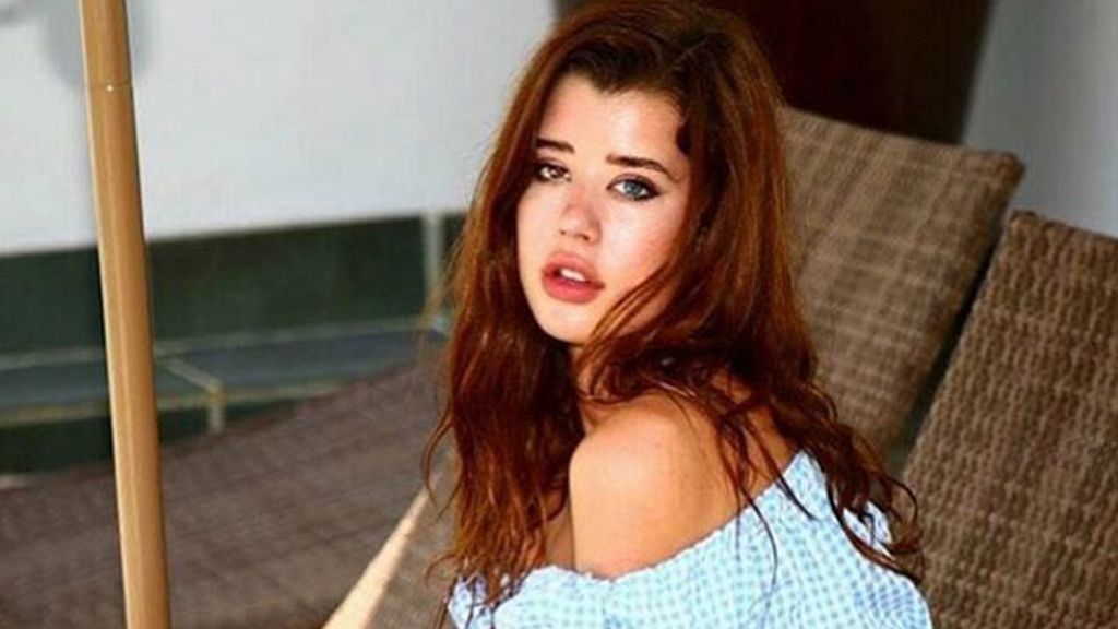 Nació con heterochromia iridum