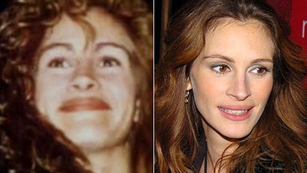 La transformación de las famosas