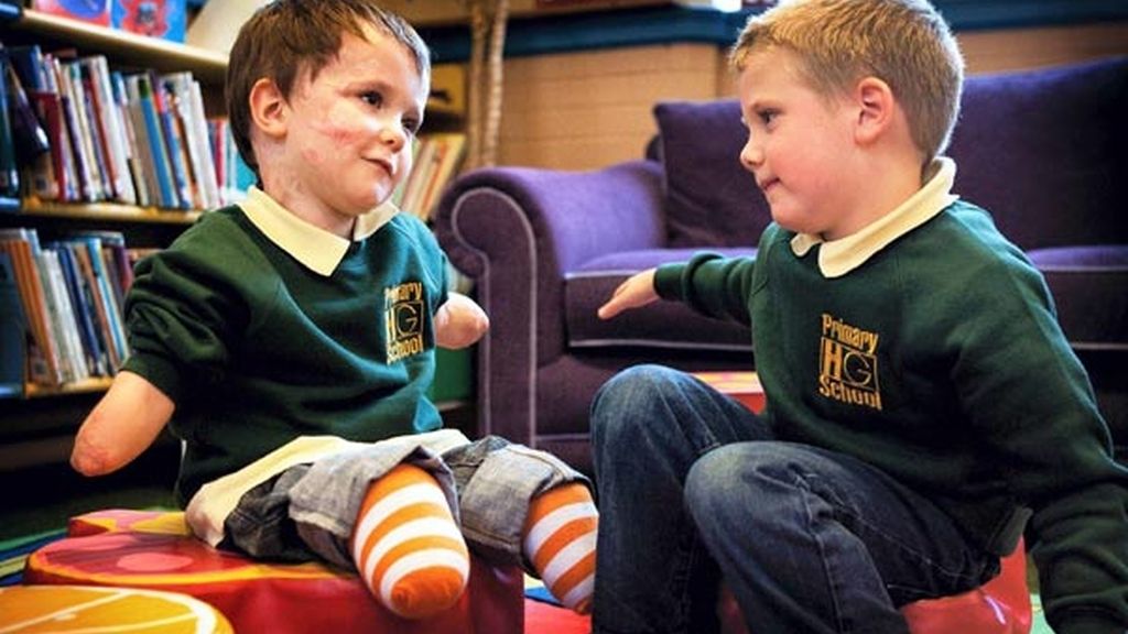 Supera una meningitis y se convierte en el niño más popular de la clase