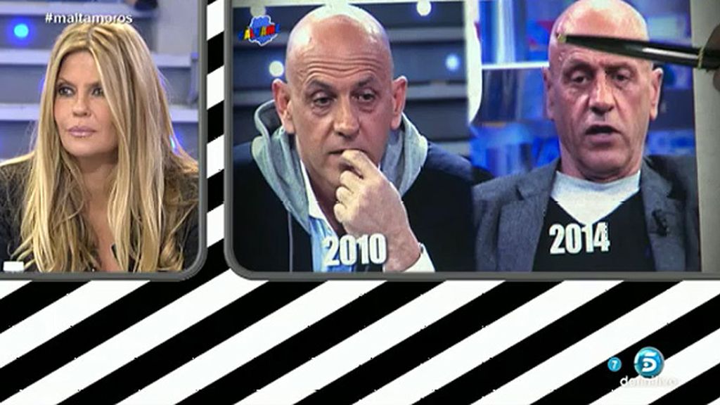 El colaborador se ha operado la nariz por un problema respiratorio