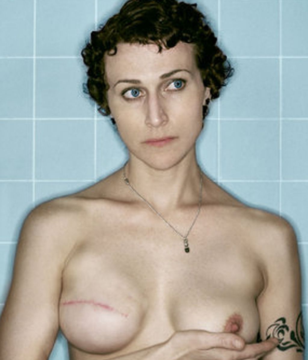 La fotógrafa Kerry Mansfield documenta su cáncer