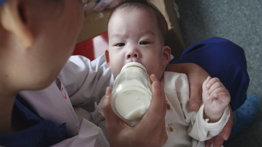 Separan con éxito a dos siamesas chinas unidas por el tronco