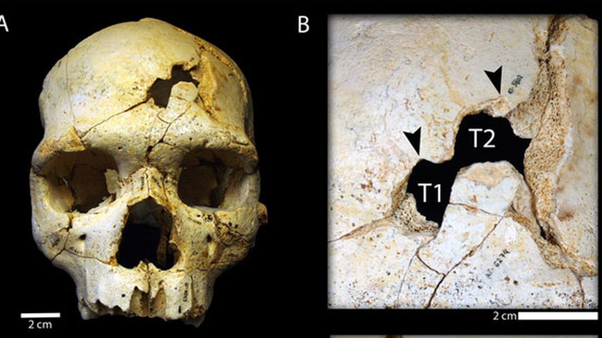 Evidencias de asesinato en un cráneo de hace 430.000 años