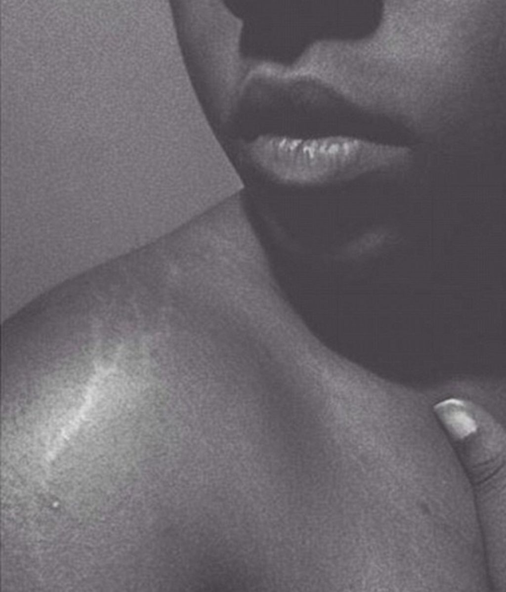 'Love your lines' una iniciativa viral lejos de retoques