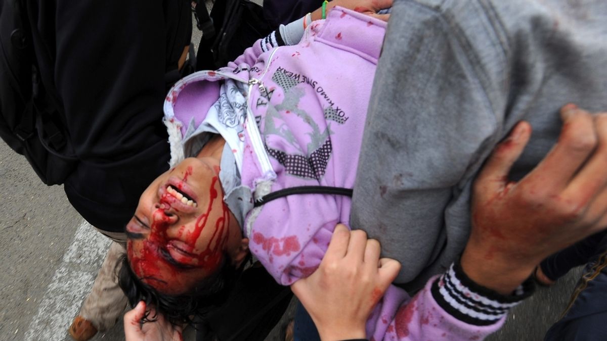 Un opositor recibe la ayuda de sus compañeros tras resultar herido durante los enfrentamientos con las fuerzas de seguridad egipcias, en El Cairo
