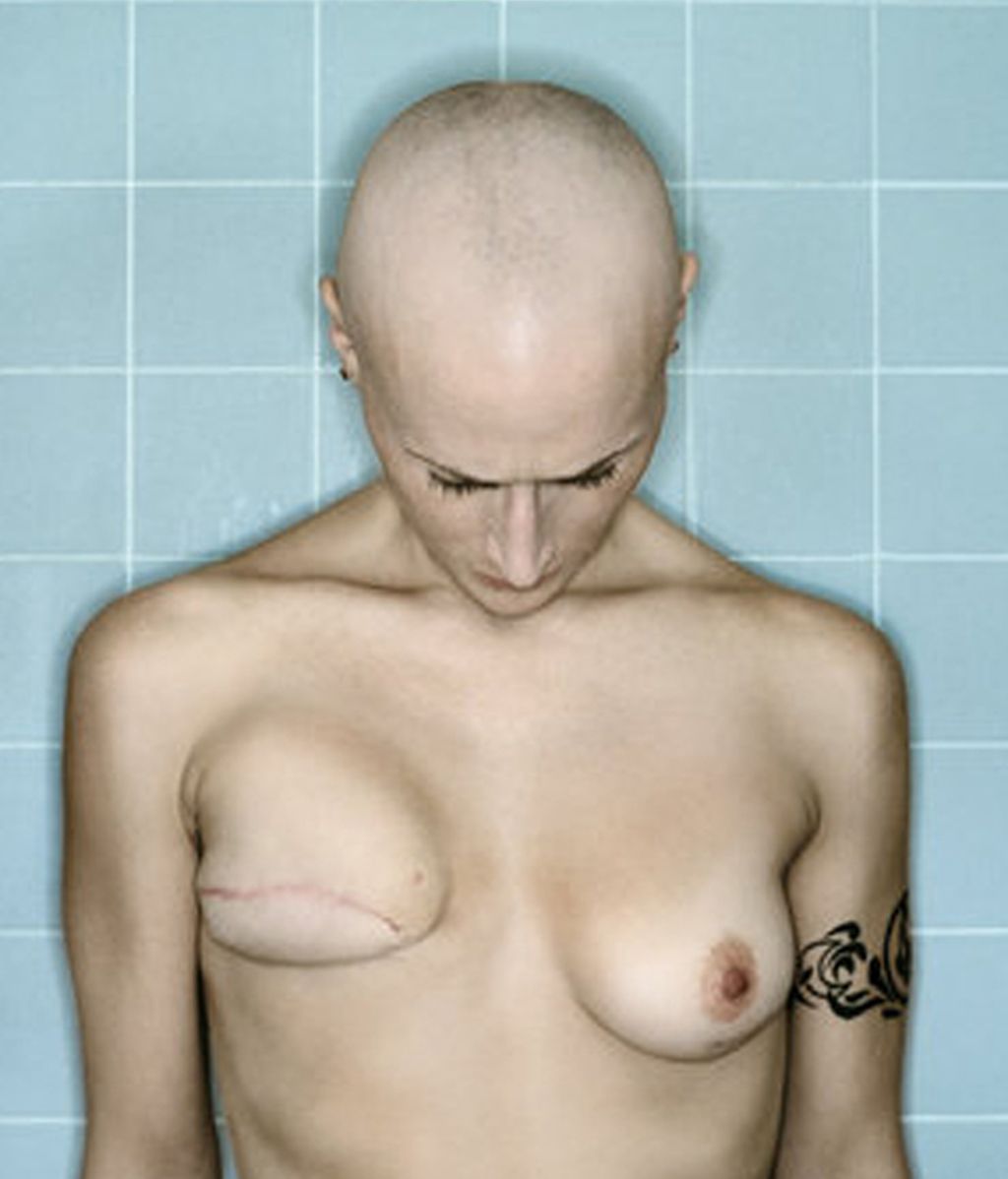 La fotógrafa Kerry Mansfield documenta su cáncer