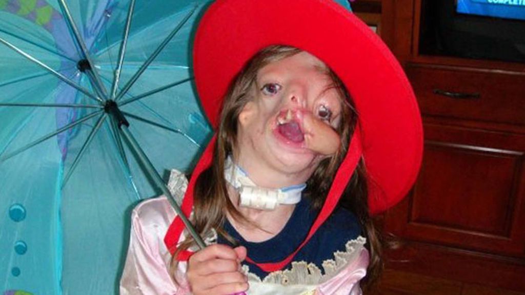 Sin cara por una malformación genética