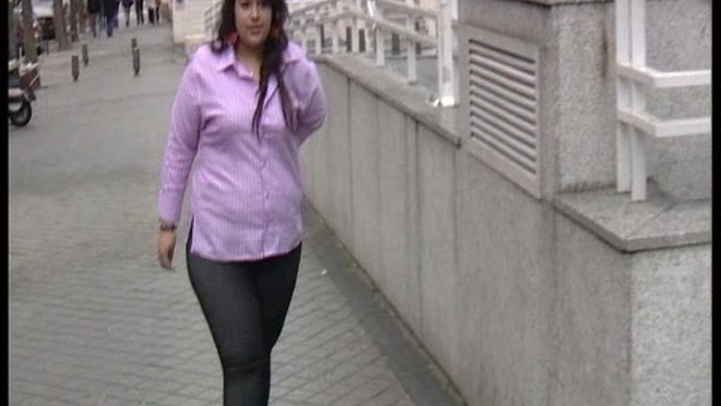 Nueva técnica contra la obesidad mórbida