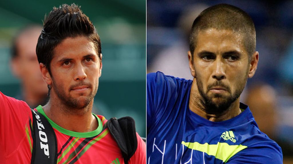 Andrea Casiraghi pierde la melena