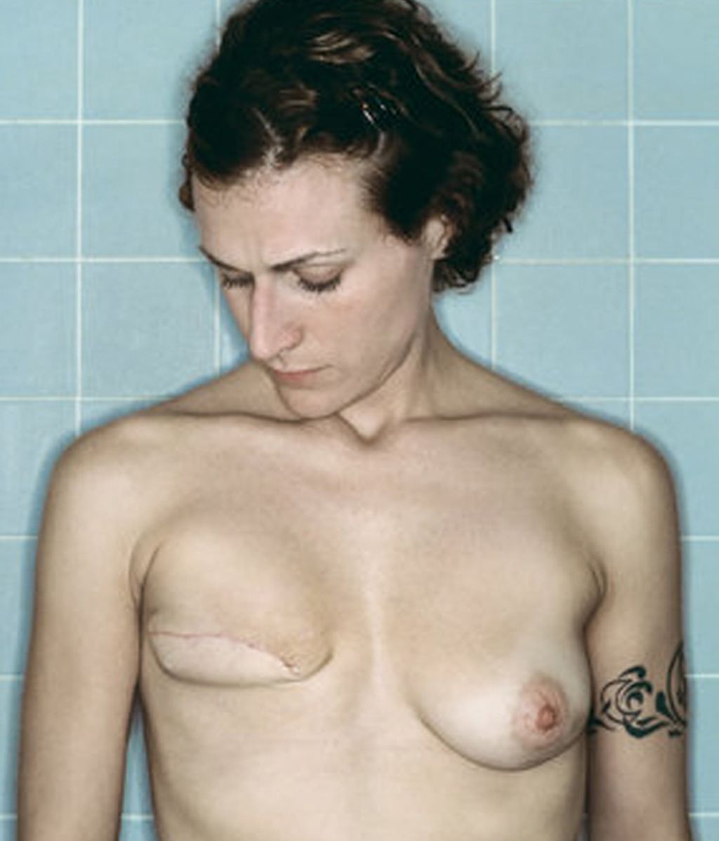 La fotógrafa Kerry Mansfield documenta su cáncer