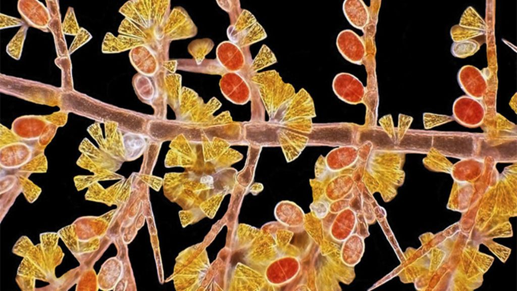 Las imágenes de microscopio ganadoras
