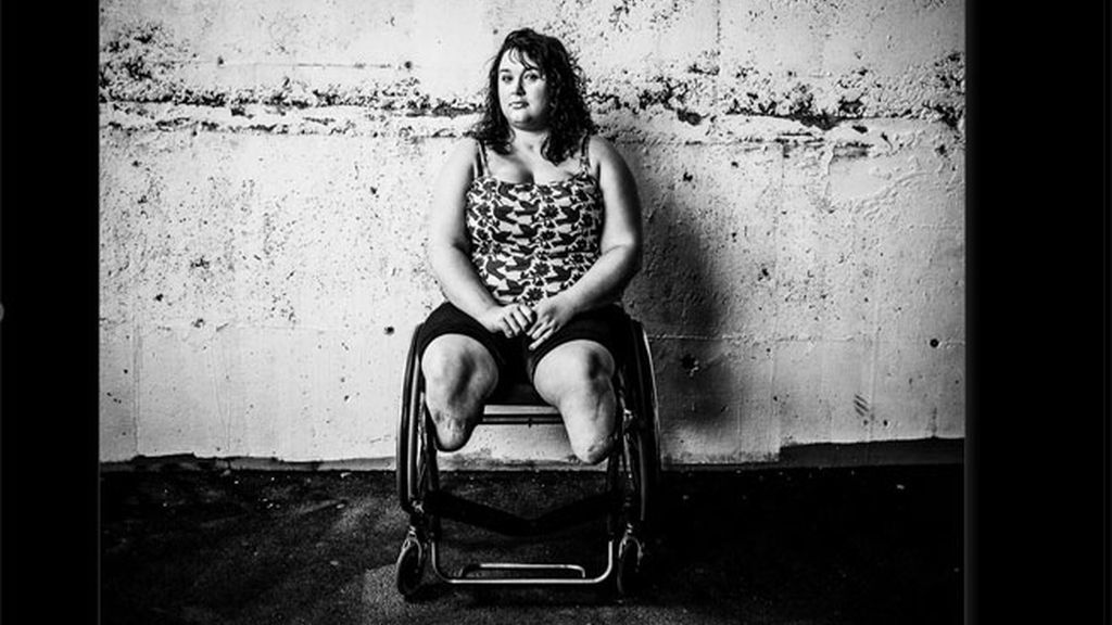 Las heridas de los soldados desconocidos