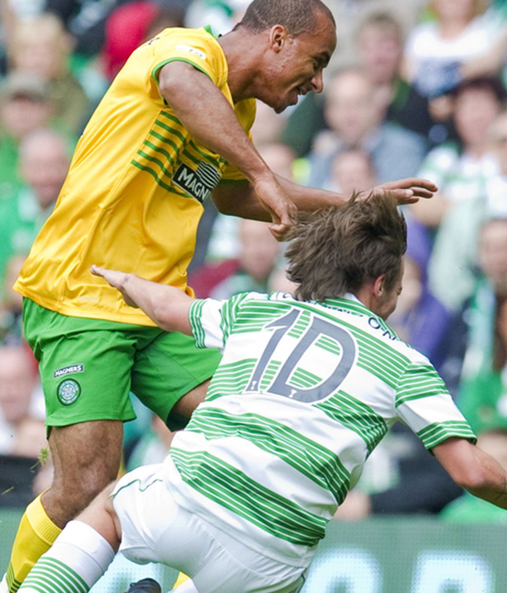 El fútbol le pasa factura a Louis Tomlinson