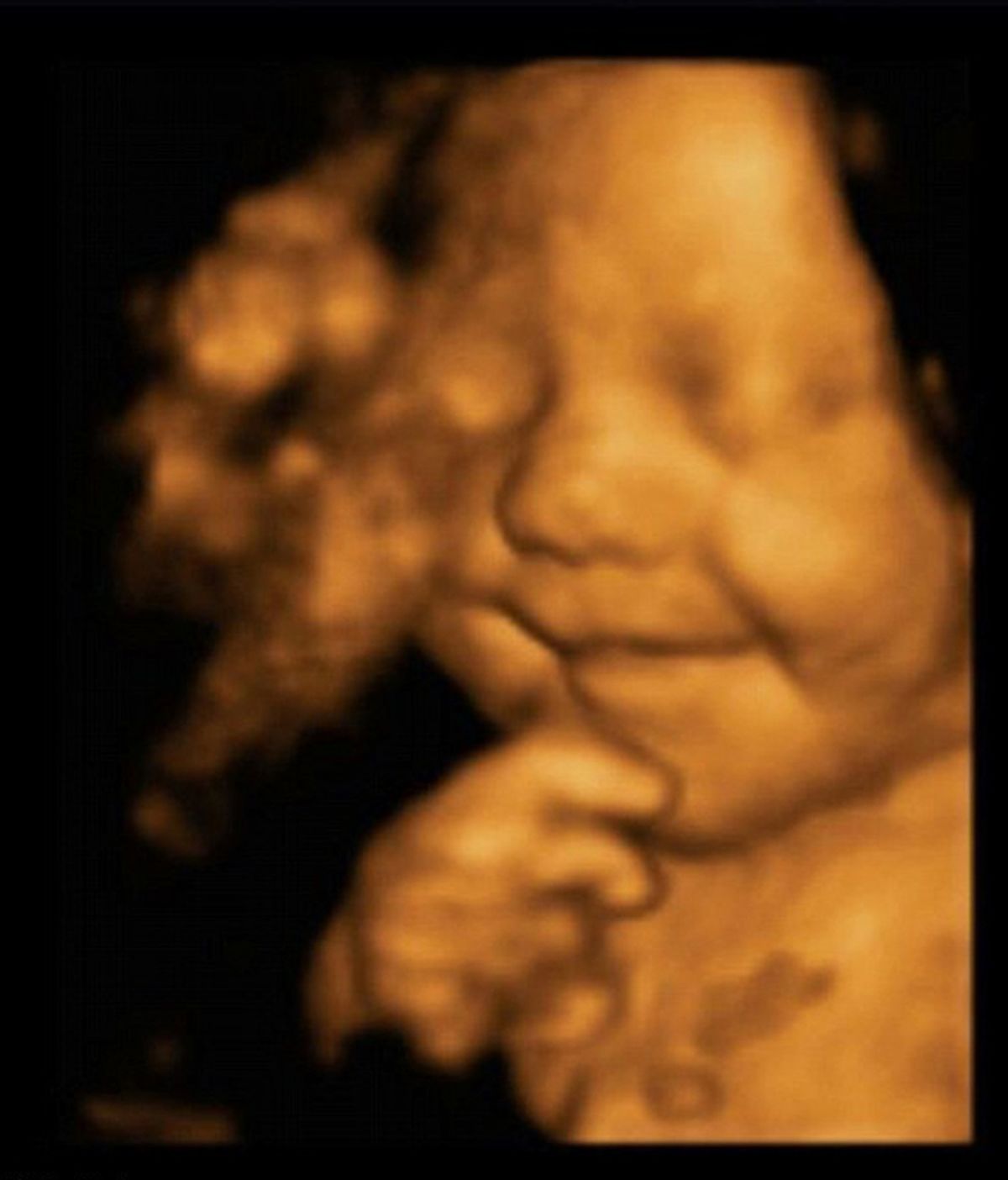 Una ecografía muestra a un bebé sonriendo antes de nacer