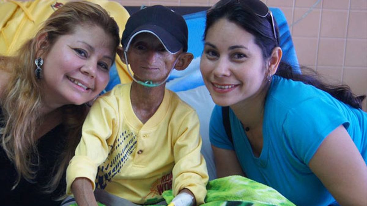 Fallece un joven con envejecimiento prematuro en Venezuela