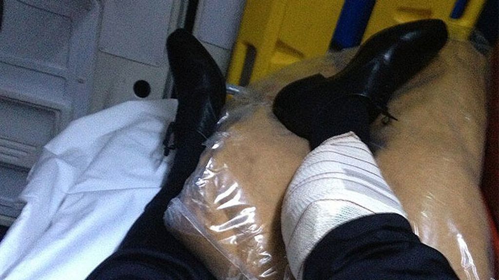 Bayona, con rotura fibrilar