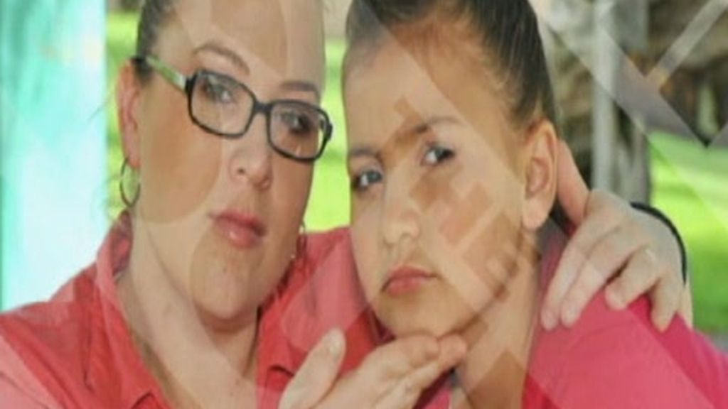 Obsesionada con el botox