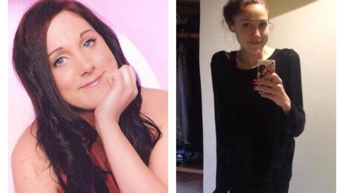 La dura lucha de una mujer de 24 años contra la anorexia