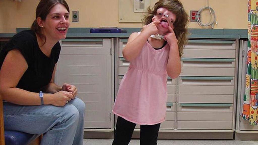 Sin cara por una malformación genética