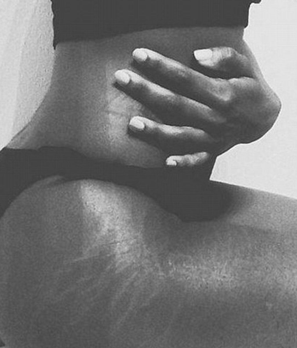 'Love your lines' una iniciativa viral lejos de retoques