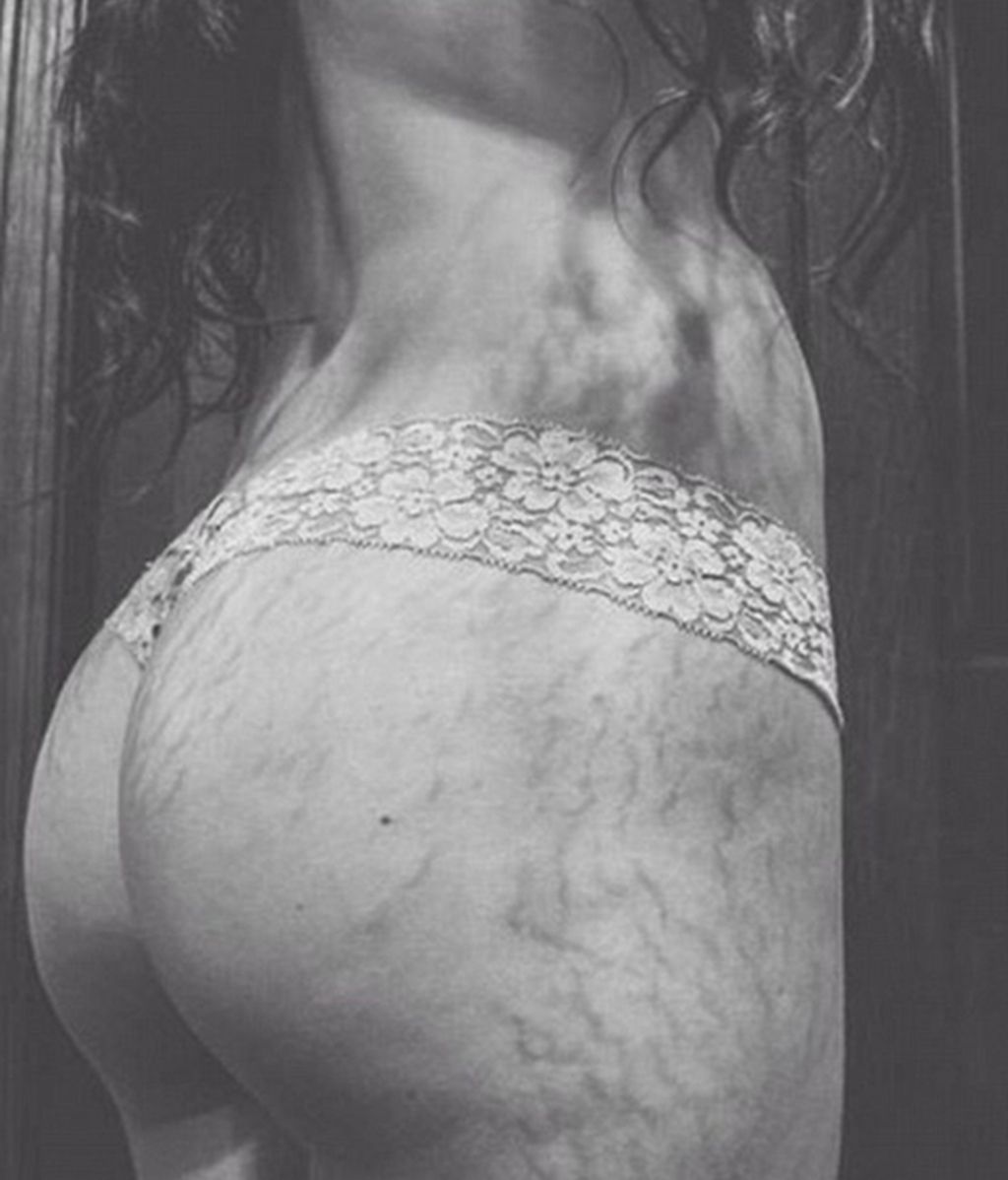 'Love your lines' una iniciativa viral lejos de retoques