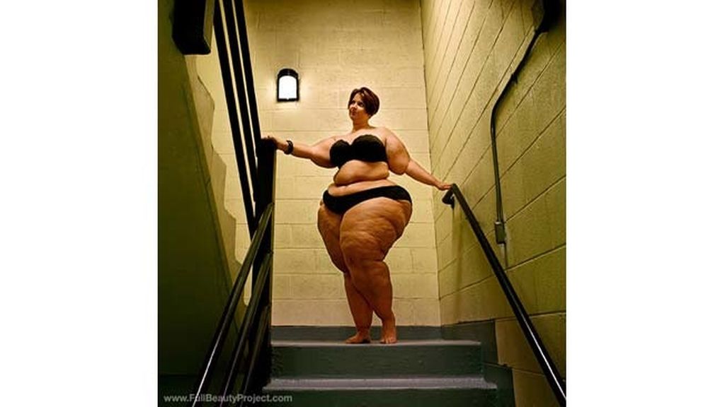 La belleza de la obesidad