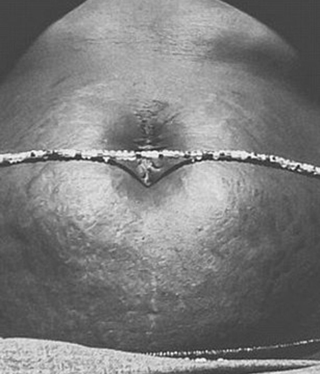 'Love your lines' una iniciativa viral lejos de retoques